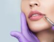 Lip Fillers Can Enhance Your Natural Beauty