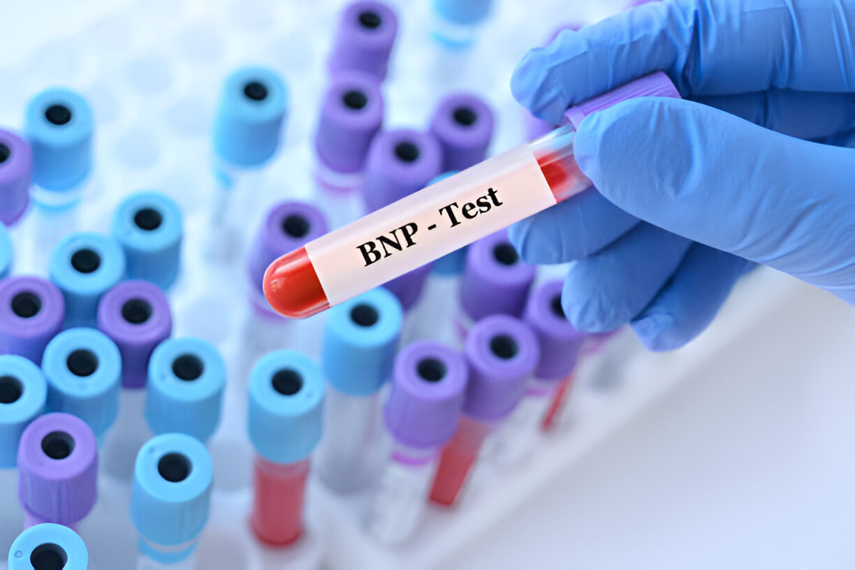 Understanding BNP and Its Importance for Heart Health - Health A Bot