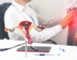 treatment for fibroids