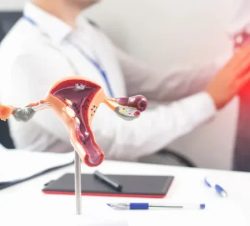 treatment for fibroids