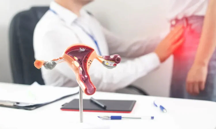 treatment for fibroids