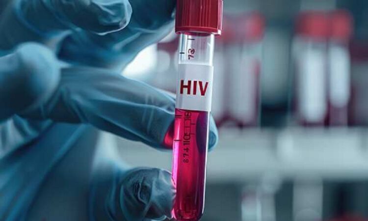 HIV Testing in Dubai